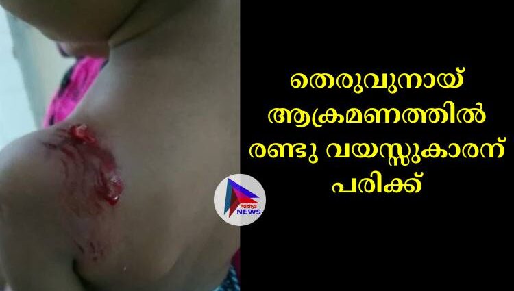 തെരുവുനായ് ആക്രമണത്തില്‍ രണ്ടു വയസ്സുകാരന് പരിക്ക്