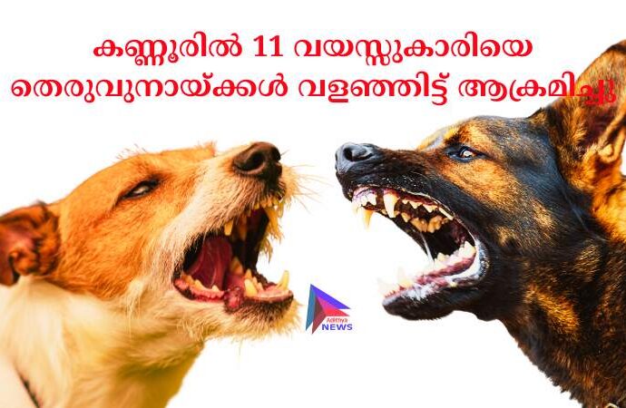 കണ്ണൂരില്‍ 11 വയസ്സുകാരിയെ തെരുവുനായ്ക്കള്‍ വളഞ്ഞിട്ട് ആക്രമിച്ചു