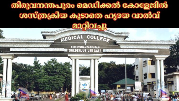 തിരുവനന്തപുരം മെഡിക്കൽ കോളേജിൽ ശസ്ത്രക്രിയ കൂടാതെ ഹൃദയ വാൽവ് മാറ്റിവച്ചു