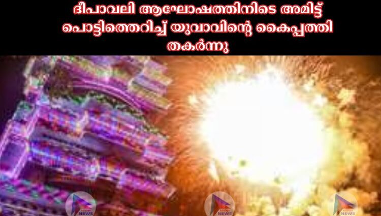 ദീപാവലി ആഘോഷത്തിനിടെ അമിട്ട് പൊട്ടിത്തെറിച്ച്‌ യുവാവിന്റെ കൈപ്പത്തി തകര്‍ന്നു